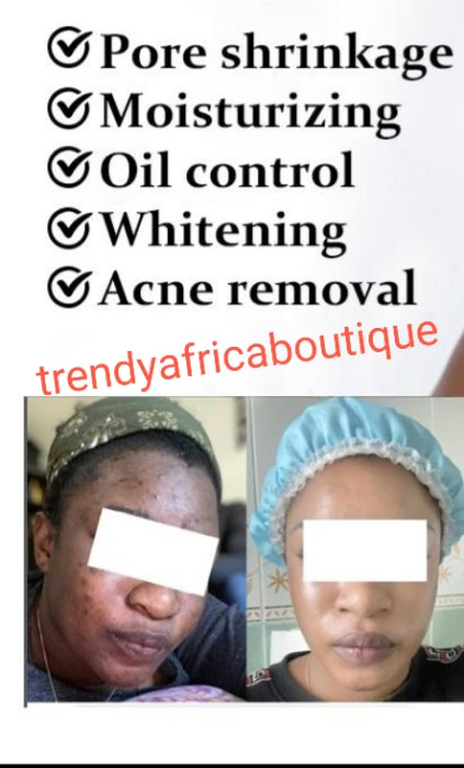 3pc.Morning Routine Anti Acne set facial treatment: Cleanser, toner & serum. ALL skin type: get rid of pimples; Black heads/white heads, UNCLOG PORES Visible Results in 7 to 10 days Active ingredient is Salicylic acid.