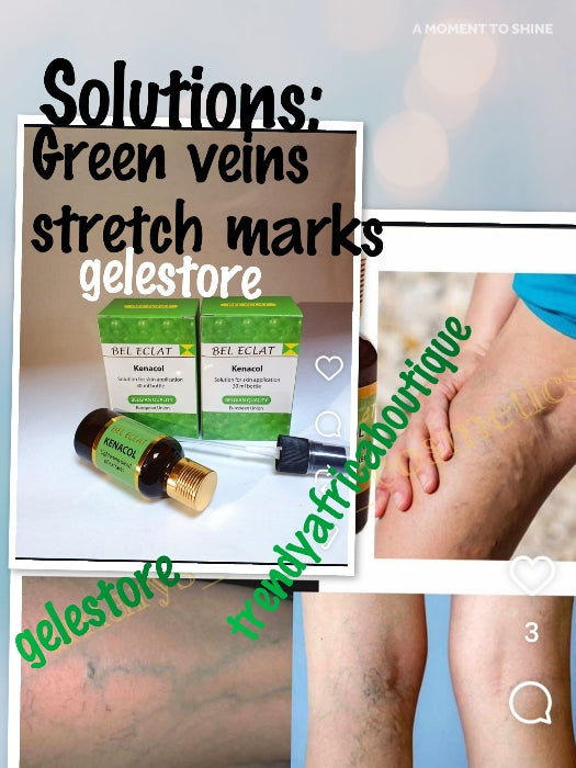 Bel Eclate, Kenacol Serum/Öl, konzentrierte Formel, 30 ml, tolles Anti-Reaktionsöl zur Vorbeugung, Reparatur und Behandlung von weißen Flecken/Punkten usw. NUR in Ihre Lotion mischen.