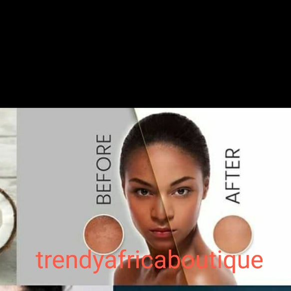 AUTHENTISCHES Set bestehend aus Bronze Tone, Lotion 300 ml, Serum 90 ml, Seife und Gesichtscreme zur Korrektur von Mitessern. Erzielen Sie einen karamellfarbenen Hautton mit der Bronzeton-Hautpflege