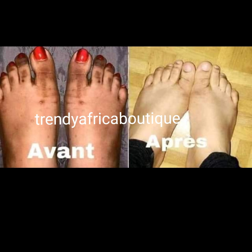 Melie White tonique whitening lotion (cleanser) effective dark spots, black knuckles eraser, gentle tonique face and hands cleanser soften and clears dark spots fast. 100ml bottle. 100% satisfaction.