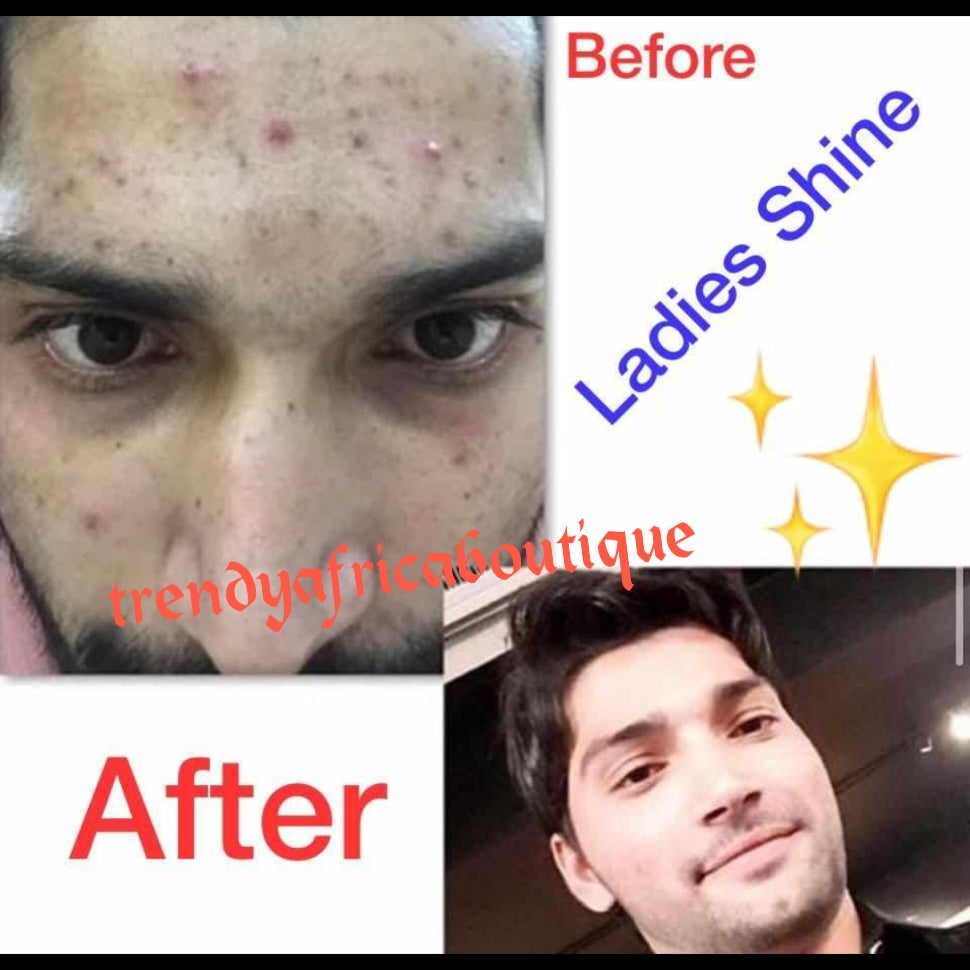 BACK IN STOCK!! DSM phyto collegen Ladies shine advanced Whitening formular. Anti black spots, anti aging made with all natural ingredients supplements 800g jarwhitening and anti aging formula supplements. Super glowing,