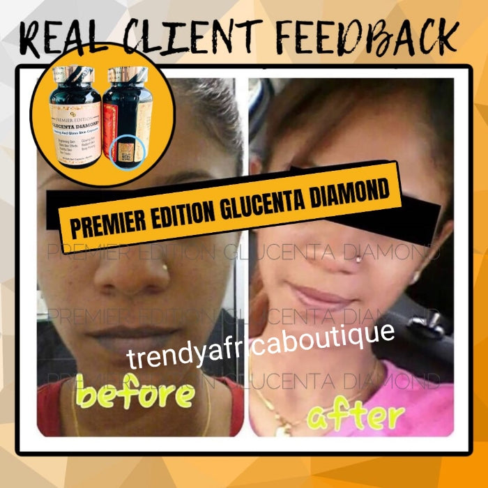 PREMIER EDITION GLUCENTA DIAMOND, skin Brightening & GLOWING skin combo with frozen collagen whiteningx10 perfect combo supplements
