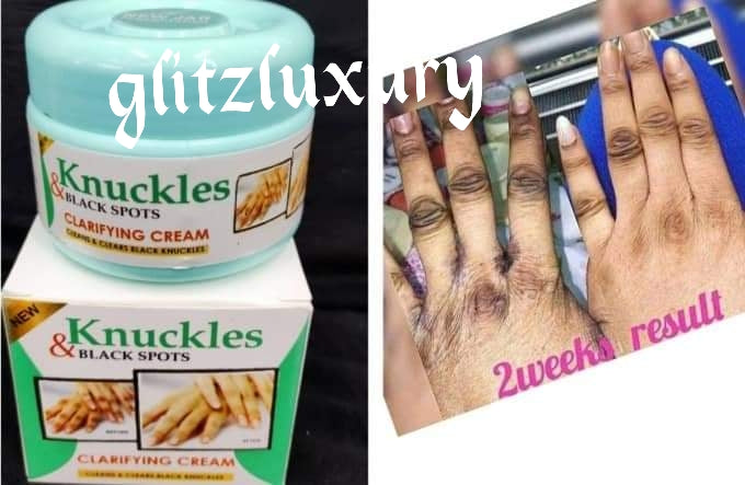 BACK IN STOCK!!! ORIGINAL Knuckles and Black spots clarifying cream 150gm jar. Cleans and clears stubborn black spots from tough areas of the body..