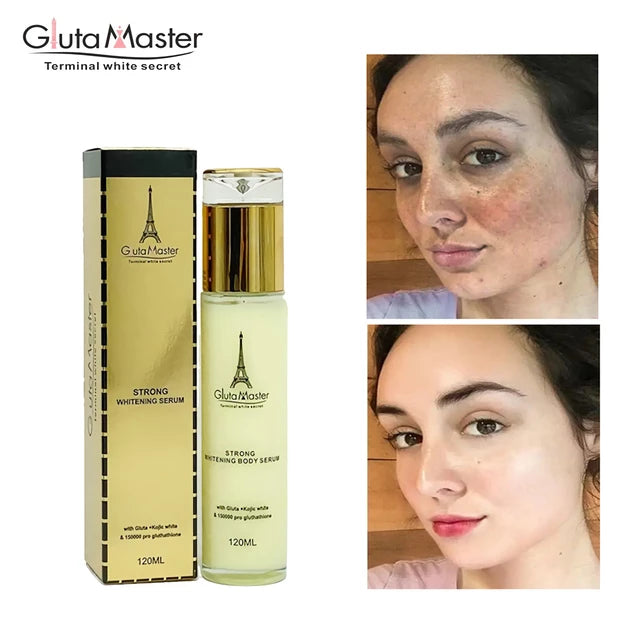 Gluta Master Terminal White Secret Serum mit Glutathion + Kojic White. Anti-Flecken und Markierungen. X 1 Flasche. 120-ml-Flasche. Nur mit Körperlotion oder Creme mischen.