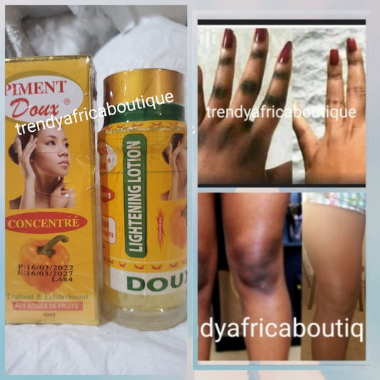 Perfect knuckles combo: 2 n 1 set: Piment doux lightening serum + exfoliating cleanser effectively clears hyperpigmentations areas like knuckles, knees etc 60ml per bottle each.