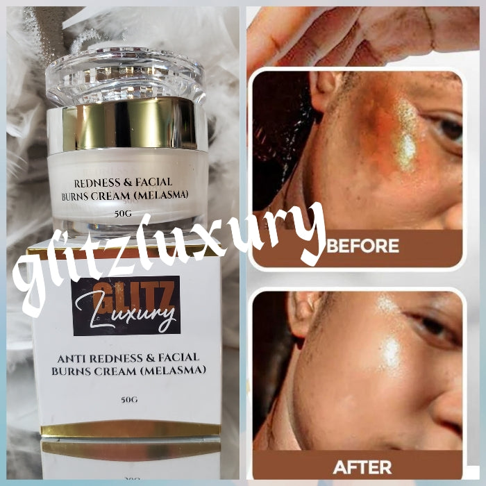 GLITZLUXURY EXCLUSIVE anti Redness and sun burn Whitening face cream Anti malasma. Super effective fast ACTIO👌.Now bigger jar 50g x 1