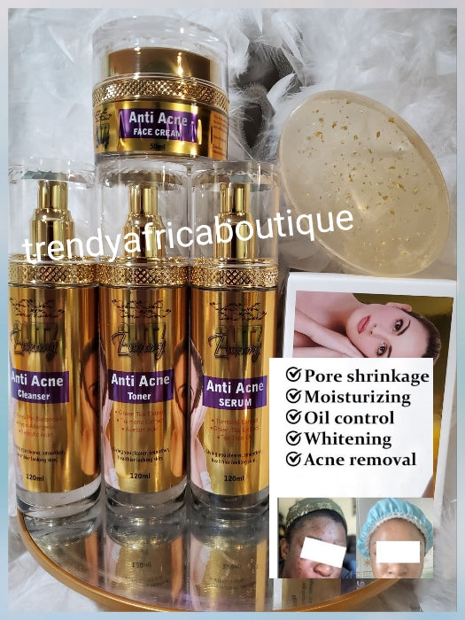 Sturborn acne/ pimples: Glitzluxury 5pcs AntiAcne treatment set: Facial cleanser, toner, serum, face cream and soap for all skin type: get rid of pimples; Black heads/white heads,Visible Results in 7 to 10 days Active ingredient is Salicylic  💯👌