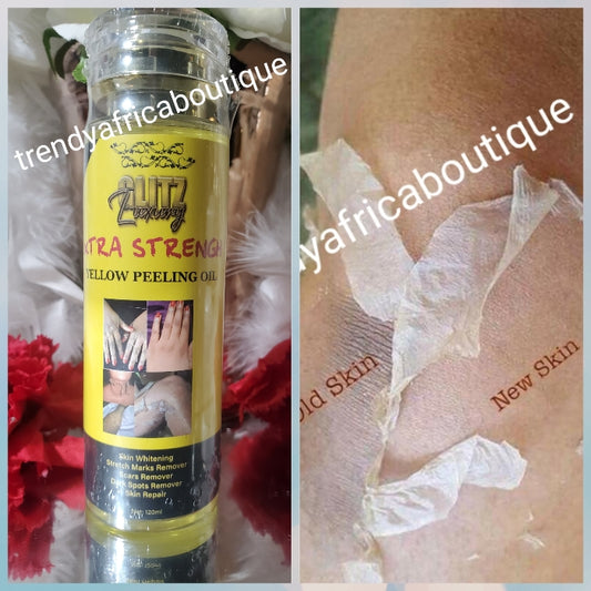 🔥🔥🔥 New product alert: Glitzluxury Xtra Strenght Yellow peeling OIL. Skin whitening, scars & stretch marks remover, skin REPAIR & DARK SPOTS ERASER from knuckles, elbows & knees. 120ml x 1