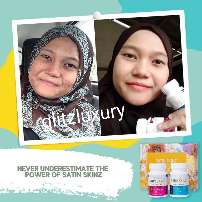 Satin Skinz gluta tab. 2 in 1 glutathion plus and Astaxathine plus.  whitening supplements for men or women. Keep your skin clear, young and glow. 5X Whitening+ anti aging tabs.