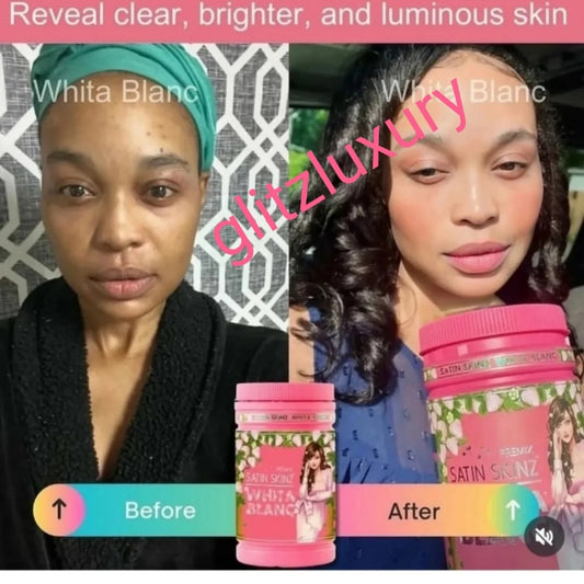 New product alert: Satin Skinz Whita Blanc powder supplements 5x more effectivein skin brightening. Treat hyperpigmentation, diminish acne & scar. 800g jar + free 3 sachets