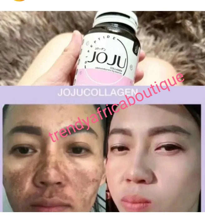 X 3 sale:  AUTHENTIC Joju collagen  ANTI ACNE supplements 30 cap in bottle. Skin brightening, Smoothen & clean skin