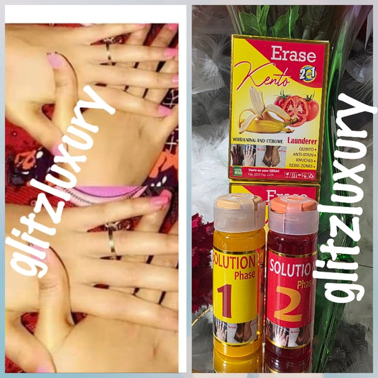 Another Bangar: Erase Kento 2 in 1 whitening anti knuckles, Anti black spots.