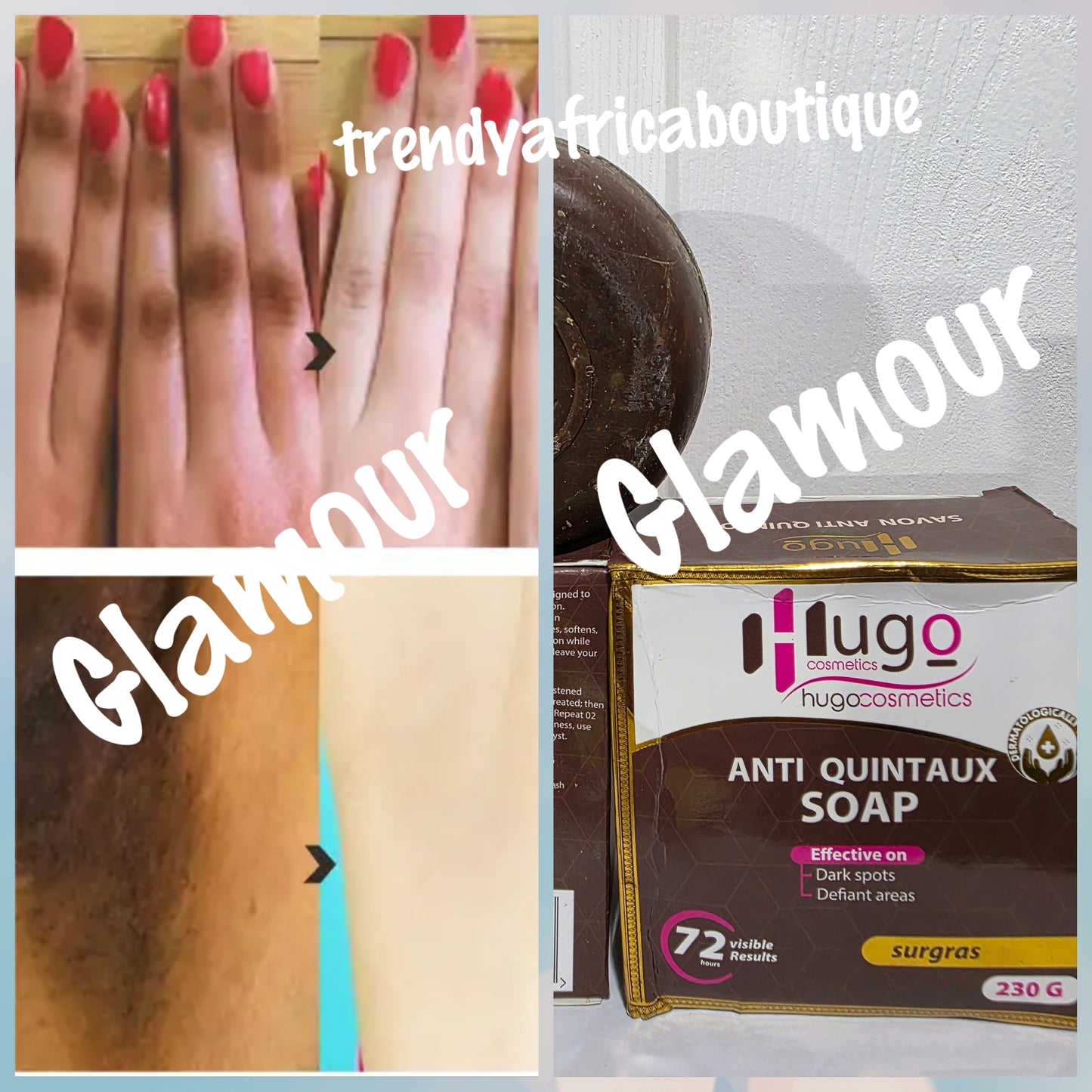 New alert: Hugo anti Quintaux  Soap (anti knuckles) effective on dark spots from difficult areas like knuckles, knees, elbows. 230g x 1 . 72hrs visible results