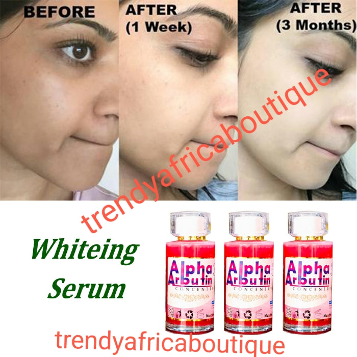 Alpha Arbutin 3 concentre, gratually whiten, brighten and even your skin tone, remove discolorations. Use directly to dark areas or you can mix a portion into your body lotion