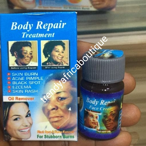 Body Repair treatment serum/oil: excellent treatment for sun burn and skin reactions 30ml x 1