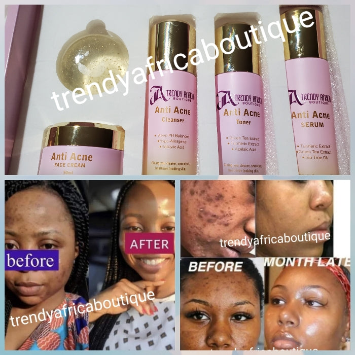 5pc. Anti Acne set: Facial cleanser, toner, serum, face cream and soap for all skin type: get rid of pimples; Black heads/white heads,Visible Results in 7 to 10 days Active ingredient is Salicylic Acid, tumeric extracts, tea tree, green tree etc.