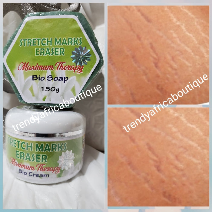 Evob Stretch Marks Eraser maximum therapy Bio cream and stretch marks soap 150g combo sale.