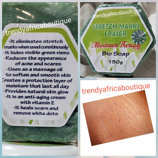 Evob Stretch Marks Eraser maximum therapy Bio soap 150g x 1 soap. Treat stretch marks, green veins, White dots and more.
