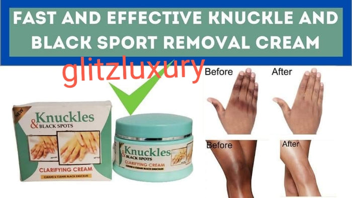 ORIGINAL Knuckles and Black spots clarifying cream 150gm jar. Cleans and clears stubborn black spots from tough areas of the body..