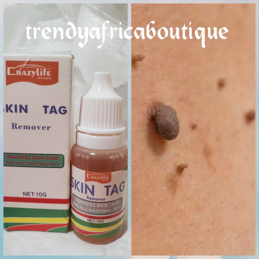 Skin tag removal serum/oil x 10gc 1