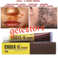 Endix-G tube cream for white dots & patches. X1 sale