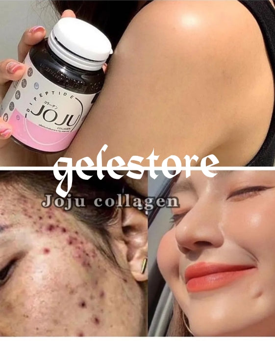 X 3 sale:  AUTHENTIC Joju collagen  ANTI ACNE supplements 30 cap in bottle. Skin brightening, Smoothen & clean skin